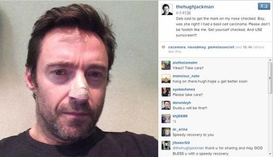 痣的位置真的有讲究吗,痣相说法为什么不一样