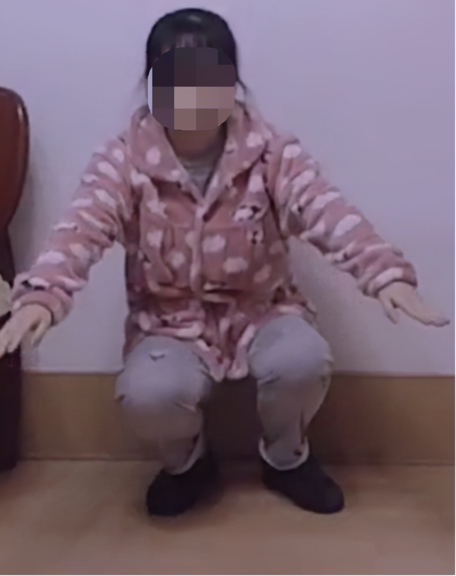 AI助力精准处理IV型髋关节发育不良花季少女翻开人生新篇章