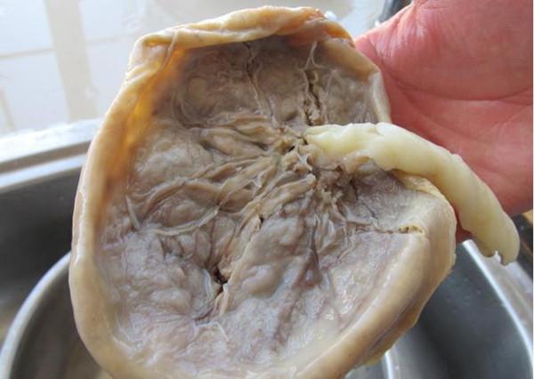 暴利胎盘市场：医药垃圾被捧成神药，一公斤卖千元小作坊变大工厂