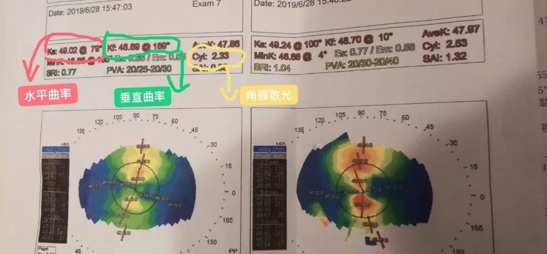 散光会引起色弱吗,散光会不会导致色弱