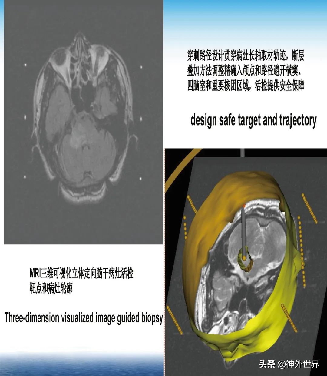 宣武医院神经外科王亚明祖籍,北京宣武医院神经科专家王亚明