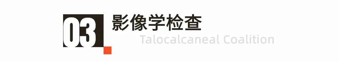 小孩玩多了脚酸脚痛怎么回事,小孩子玩着玩着就脚痛