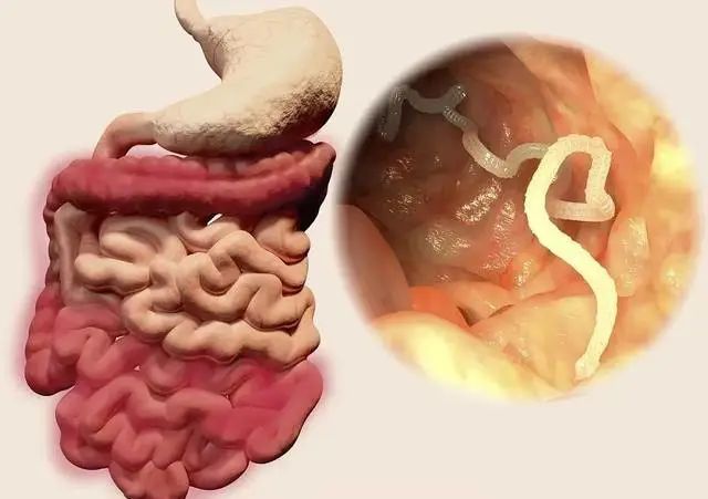 菊部周边长了个肉疙瘩,菊部旁边长了个肉疙瘩