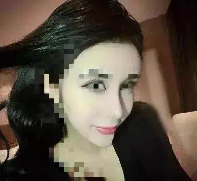 协和整形美容科专家,北京协和整形鼻综合