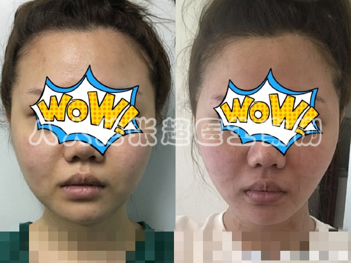 八大处整形张超,八大处张超最新视频