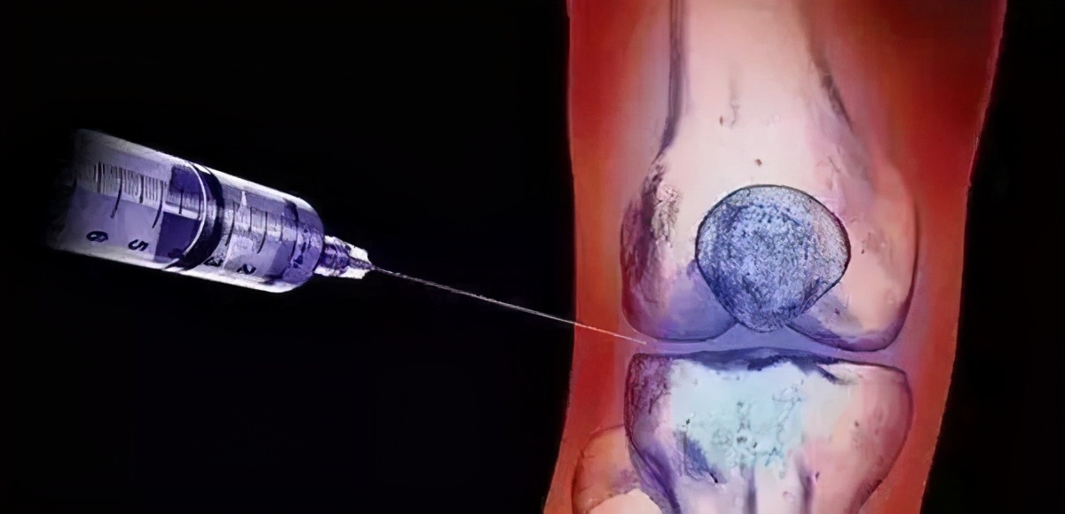 吃降尿酸药怎样防止痛风发作,有什么新药降尿酸