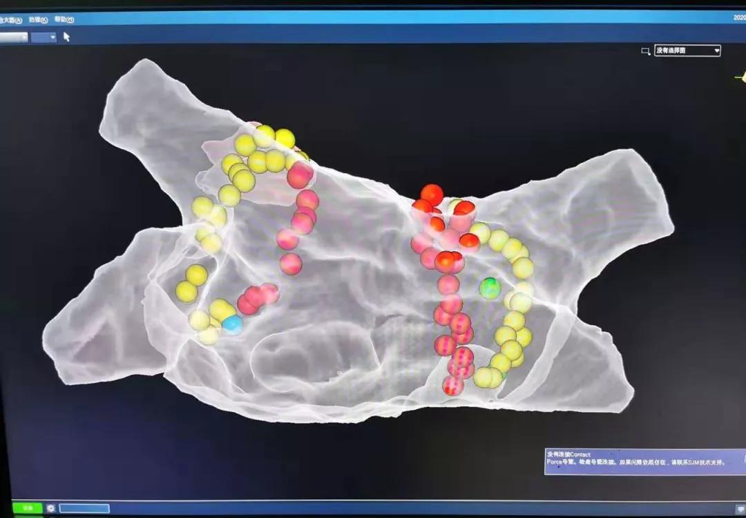 邵武市立医院心内科,中心医院房颤消融手术好吗