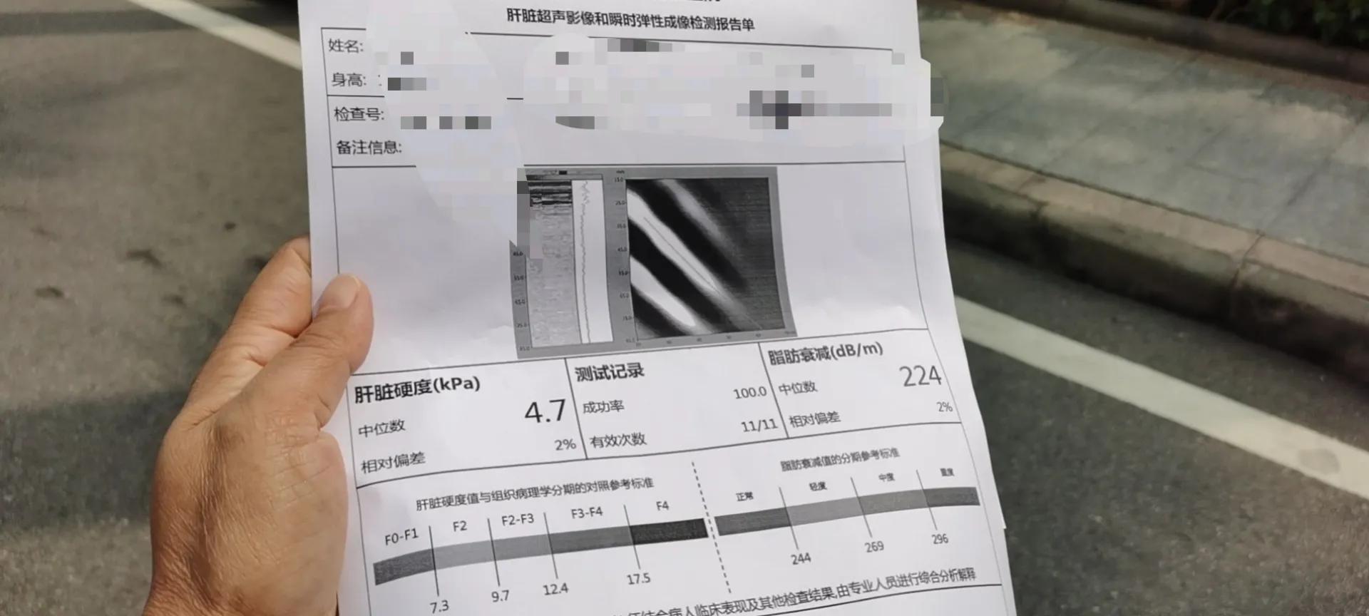 我的体检纪实5,我的体检报告