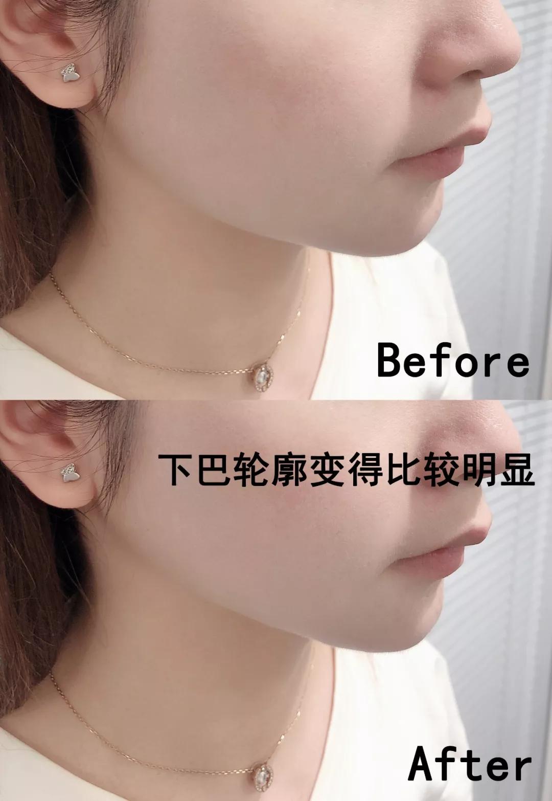 刘诗诗与倪妮再度同框,除了体态外,在脖子上她们也在暗自用力