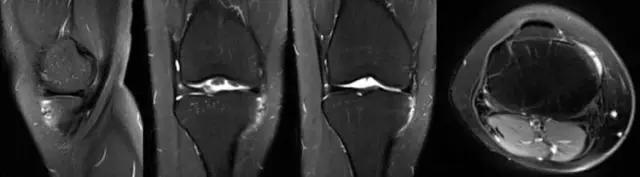 mri临床医师必读电子书,临床医生如何读mri