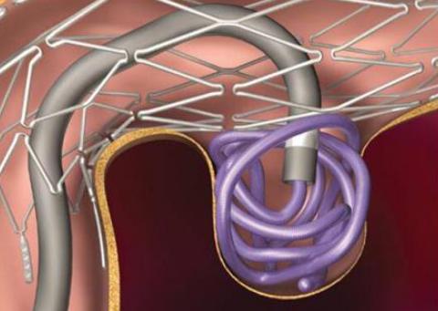 脑血管核磁共振具体检查过程,脑血管核磁共振前要注意什么