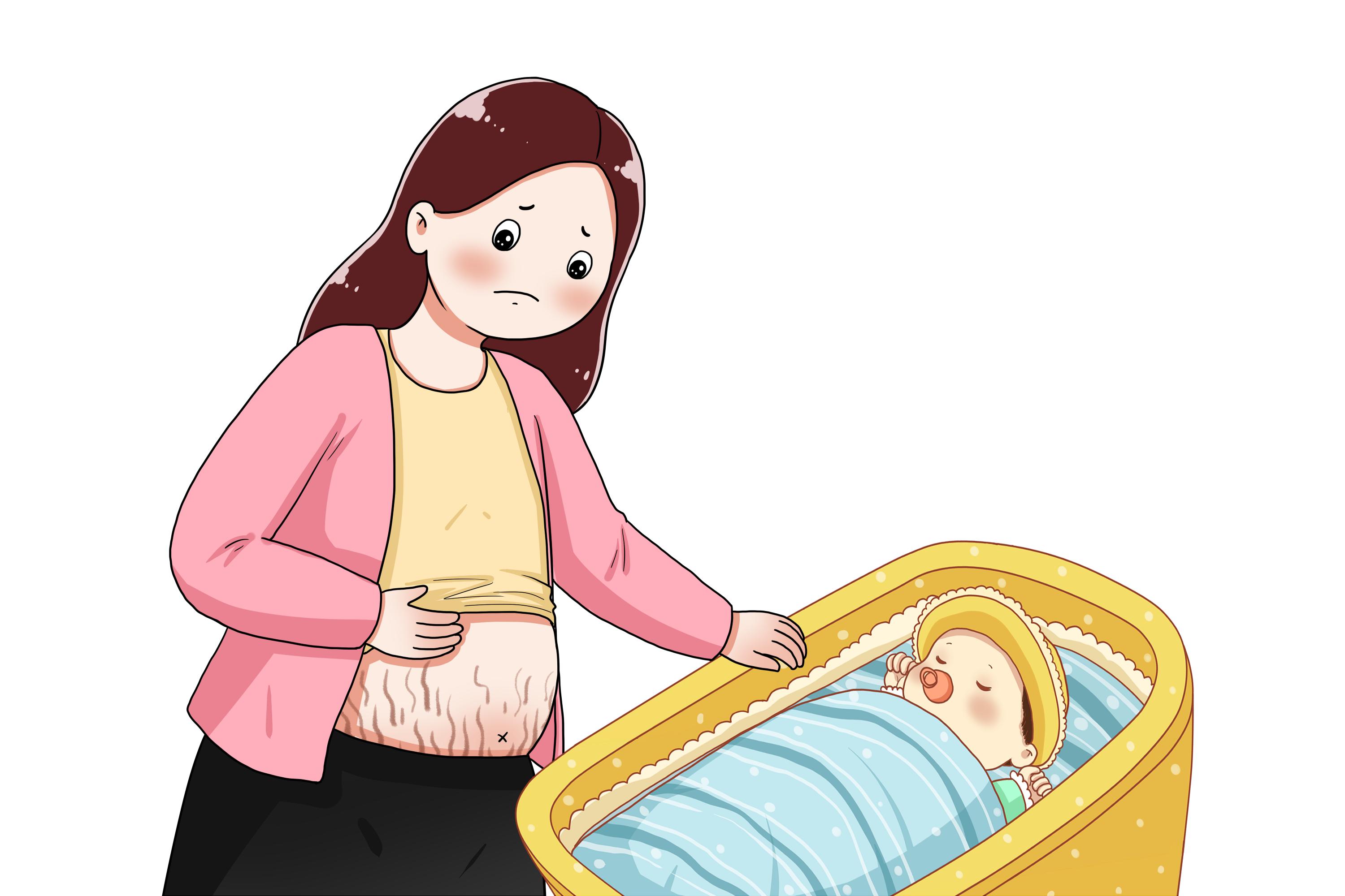 不胖却有生长纹,不胖也会有生长纹