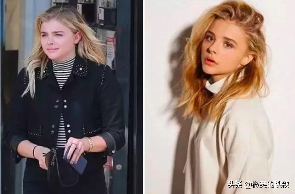 脖子敏感穿不了高领衣服怎么办,短脖子女生该如何驾驭高领衫