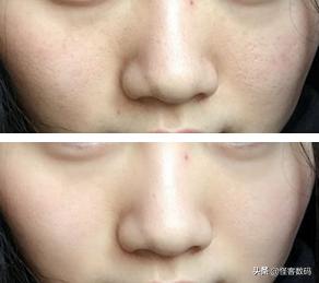 灏忕背鏈夋毚鍒╀骇鍝佸悧,灏忕背鏈夊繀瑕佸嚮绌胯涓氬悧