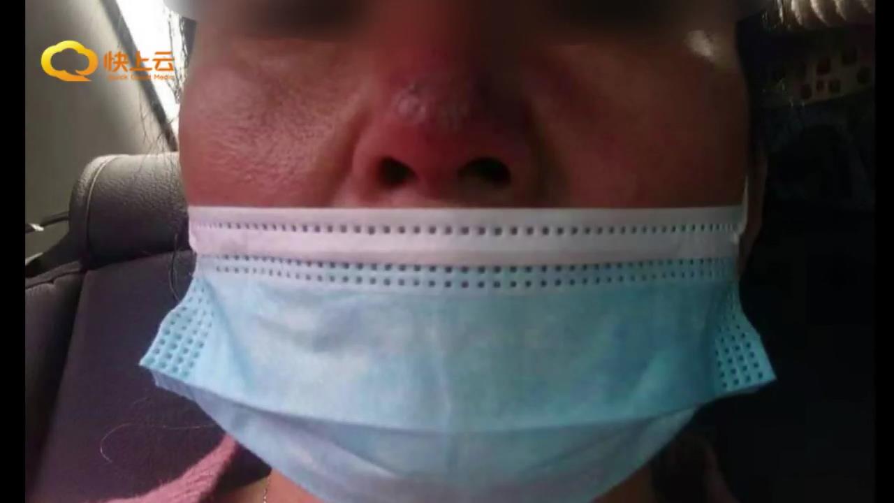 参加医美活动鼻部填充玻尿酸出现问题要说法博雅美容整形：没责任 法律途径解决