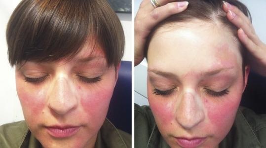 震惊｜|你都长斑了还不长点心，小心其他疾病找上你