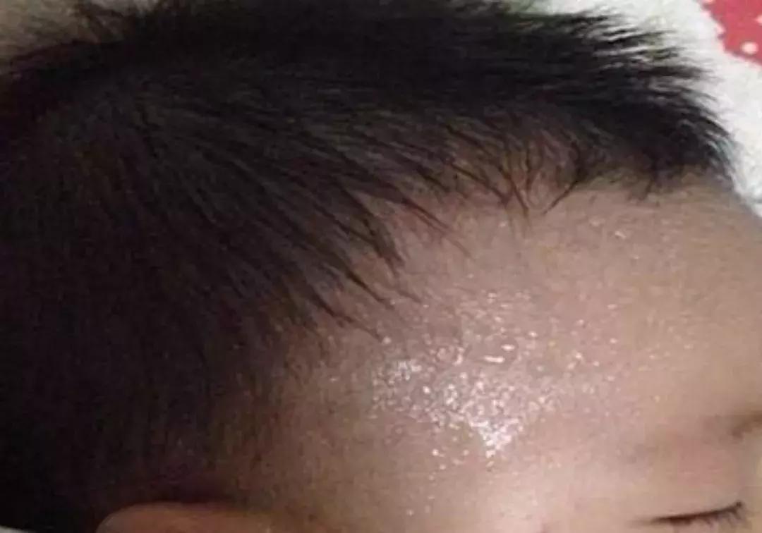 小孩子天气热长痱子怎么办,孩子天热出痱子怎么办