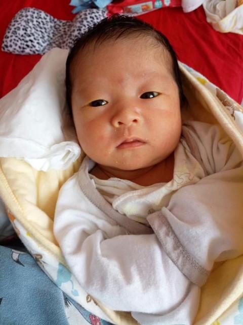 新生儿黄疸需要停母乳吃药吗,新生儿黄疸需要吃益生菌吗