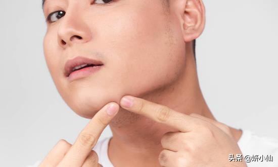 下巴长闭合性粉刺去除的方法,下巴白头粉刺是什么原因引起的