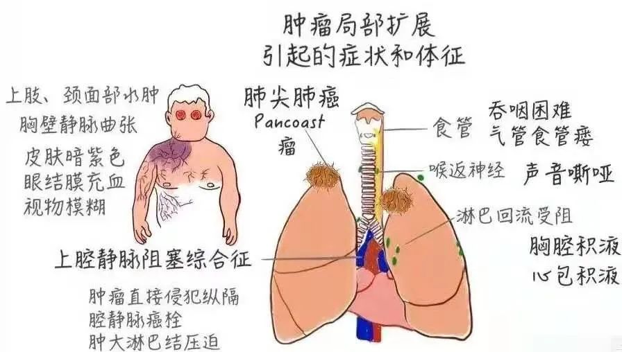 奇迹再现治愈版,医学奇迹再现视频