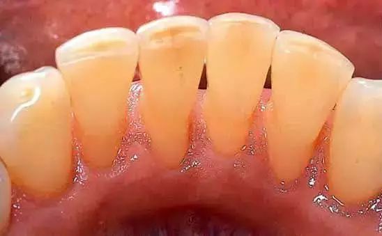 大连牙科医生牙齿缺失怎么办,大连齿医生口腔可靠吗