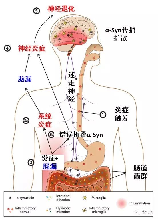 肠漏症的三大指标,肠漏症和脑漏症