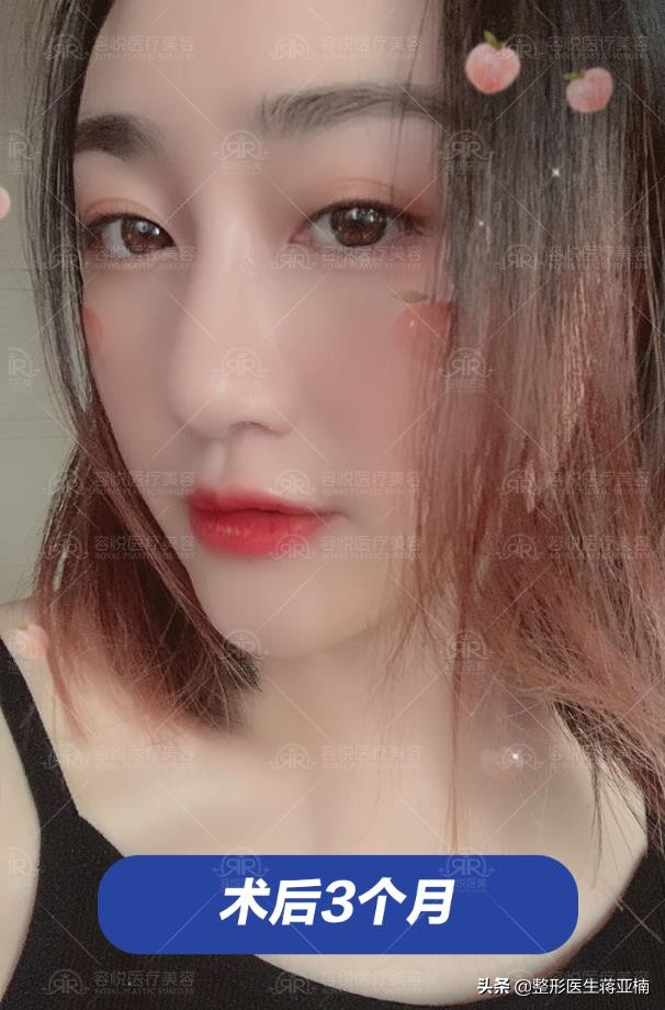 塌鼻妹逆袭,塌鼻妹