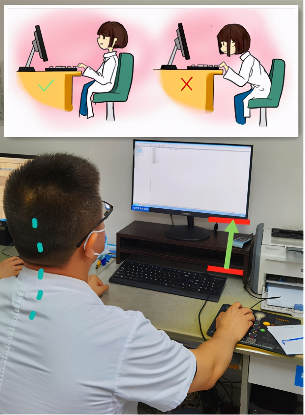 颈椎生理曲度过曲是啥意思,颈椎生理弯曲变直反弓怎么治疗