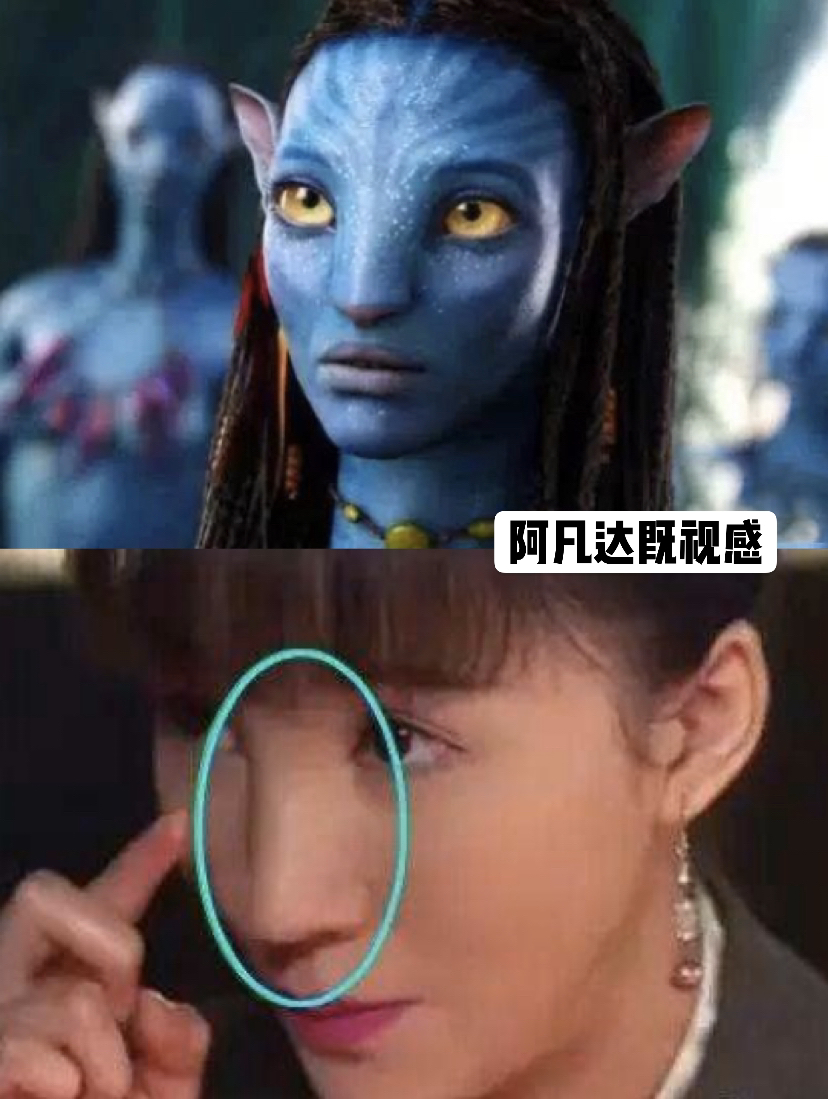 女人鼻子图解通天鼻,肋骨鼻做成了通天鼻怎么改