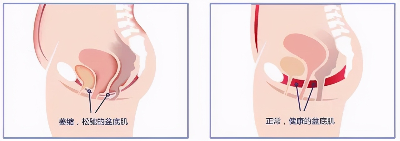 大家都在避讳这个问题，那么我来说吧