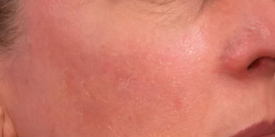 现在最流行的a醇,公认的a醇值得用吗