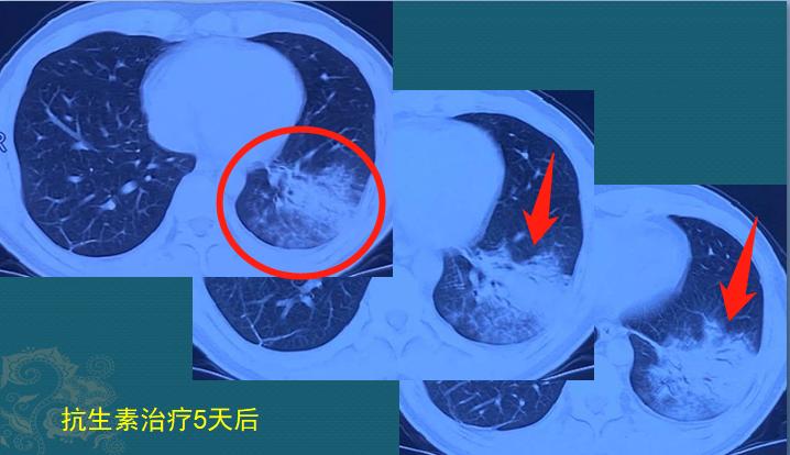 年轻人参观养鸡场，一个动作让他住院20天，损失3万块