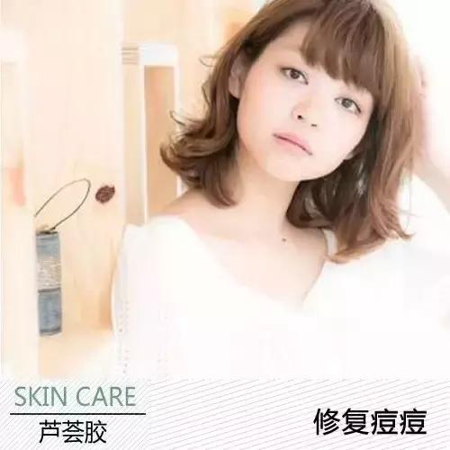 冬季皮肤干燥起皮可以用芦荟胶吗,长期涂抹芦荟胶的好处和坏处