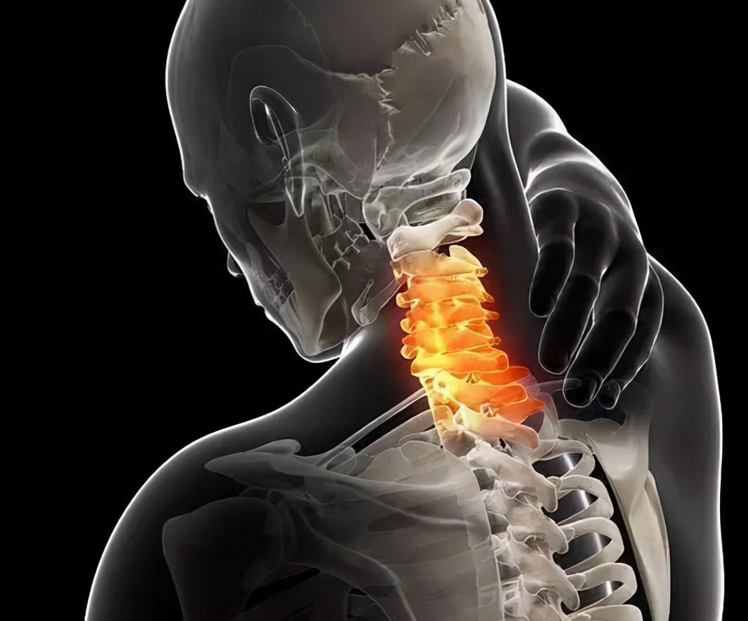 颈椎病脖子咔咔响怎么治,转动颈椎咔咔响真的是颈椎病吗