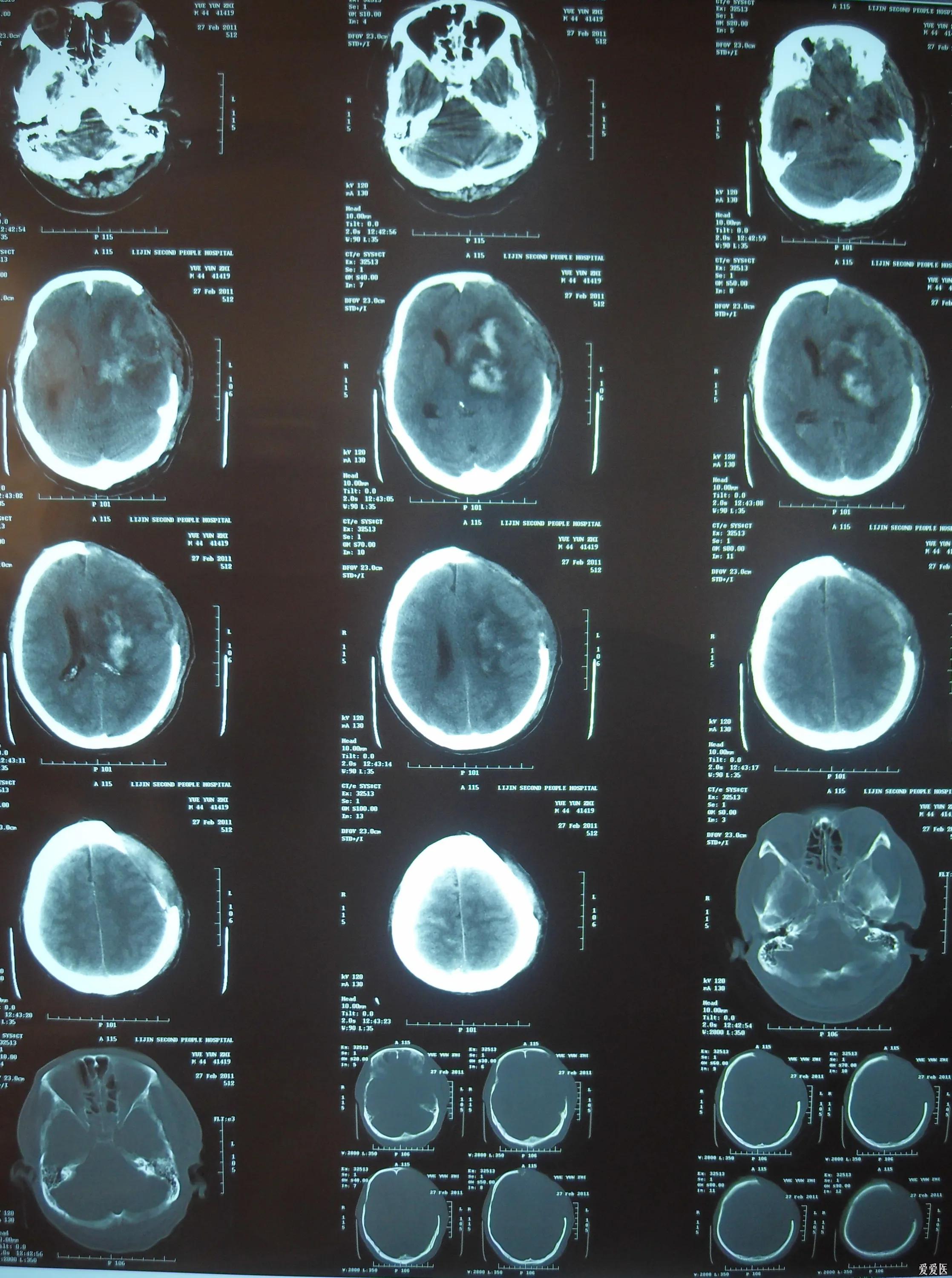 负债100万该怎么办,负债100万的真实感受