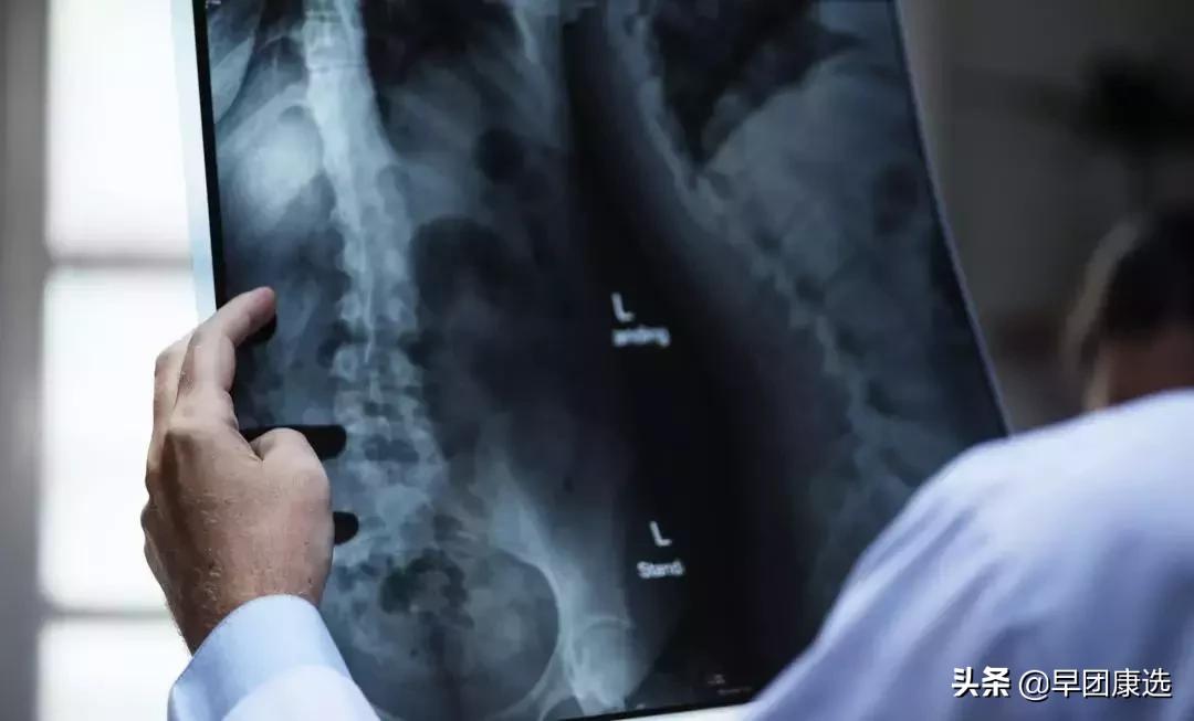 体检查出早期癌是不幸中的万幸么,年年体检为何一查出癌就是晚期