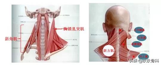 哺乳期颈肩痛怎么缓解,久坐颈肩痛的缓解方法