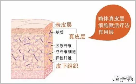 医美去颈纹全过程,去颈纹医美过程