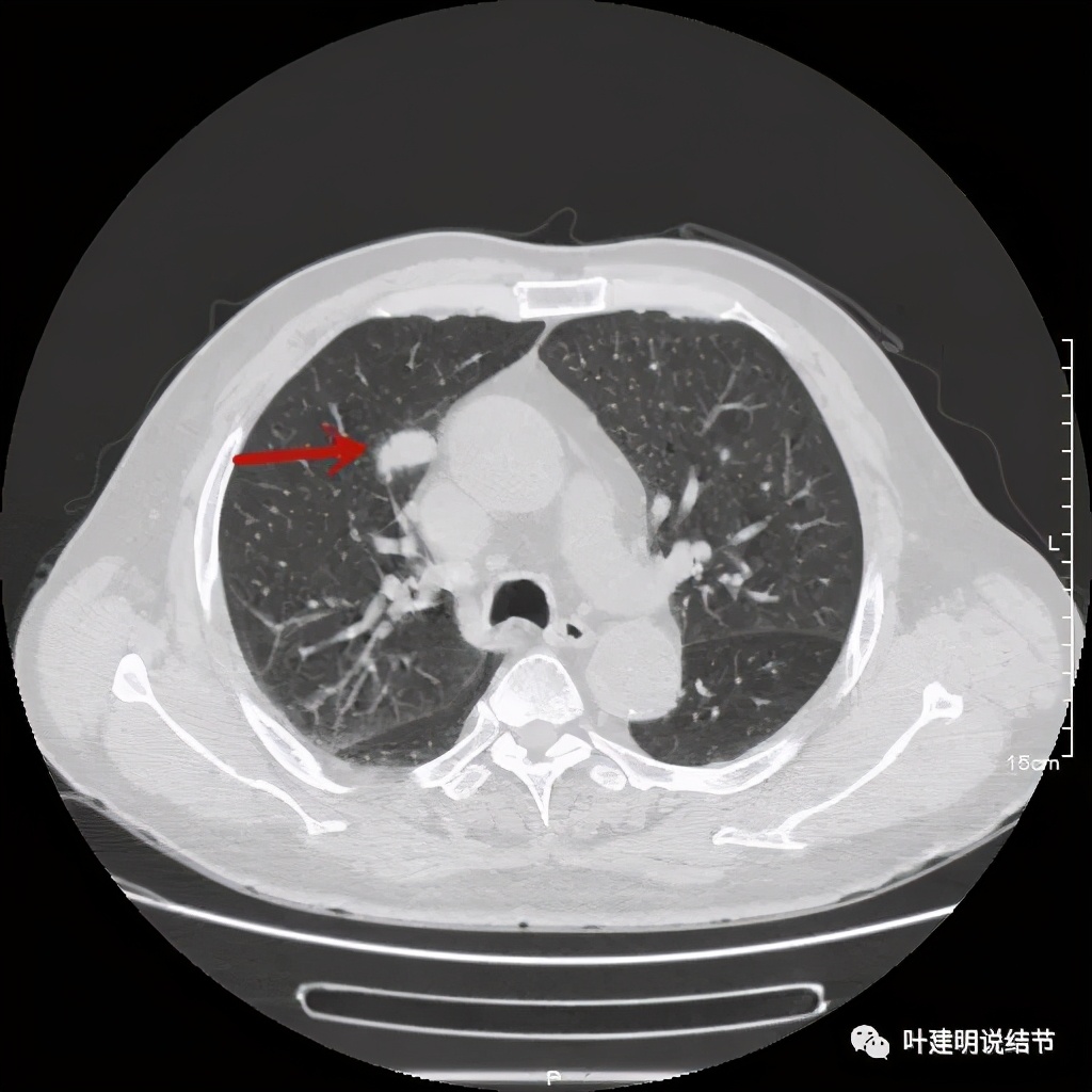 误诊报告图片,误诊案例及案例分析