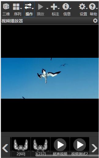 鍖诲褰卞儚鍣ㄦ潗灞曠ず瑙嗛,瓒呮竻鍖诲褰卞儚