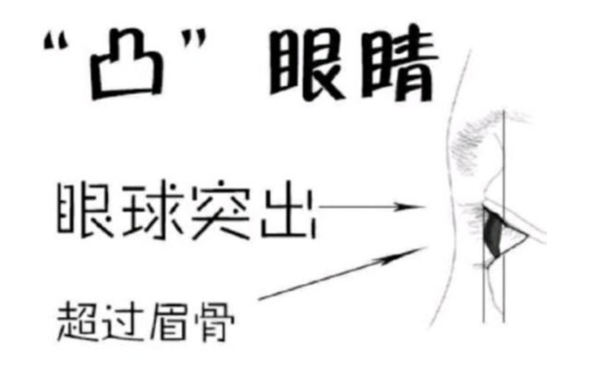 怎样让五官变立体整形,五官轮廓整形