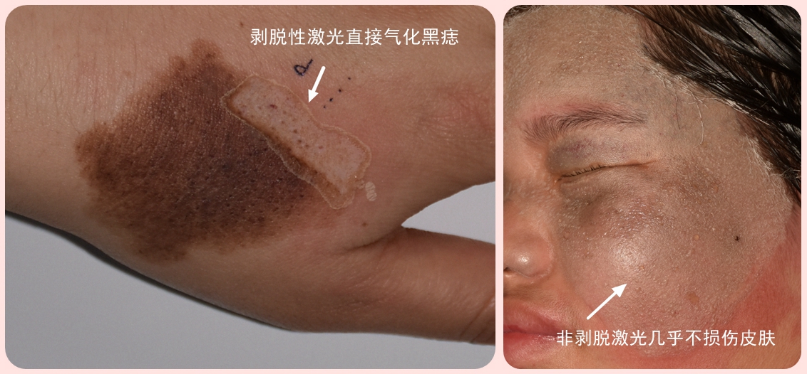 激光美容基础知识书籍,激光美容实用指南最新