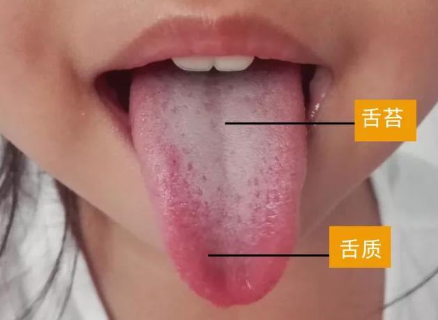 舌苔脉象与病症的关系的对应表,舌苔和病情