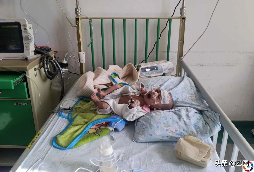 6个月的男宝才15斤,6个月的男婴体重才5公斤是正常吗