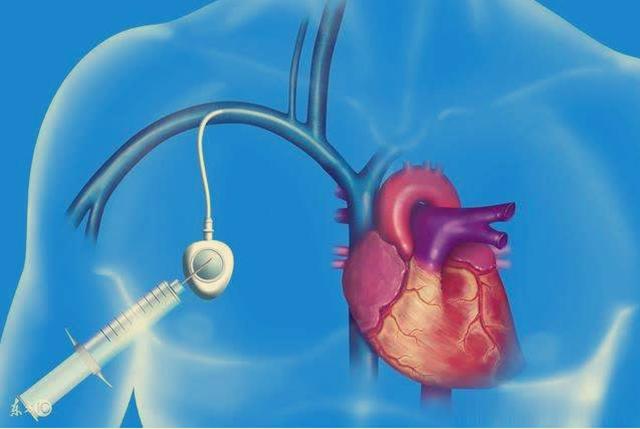 妈妈肺癌化疗失败之后,靶向治疗效果很棒!但如何解决耐药问题?