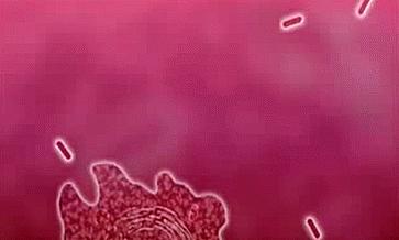 霉菌性阴道炎，是下面“发霉”了吗？