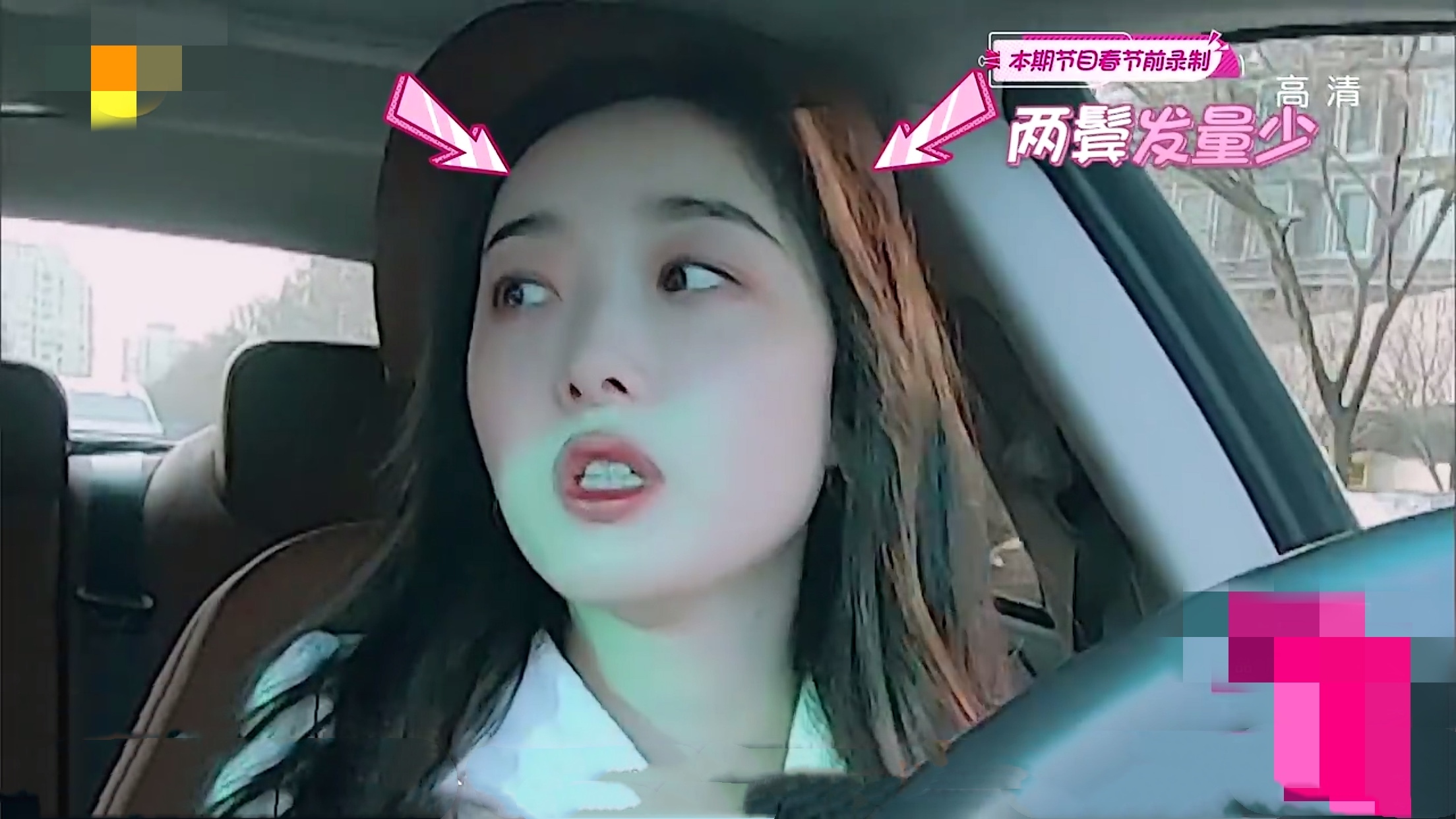 蒋梦婕植发是哪一期,蒋梦婕植发视频完整版