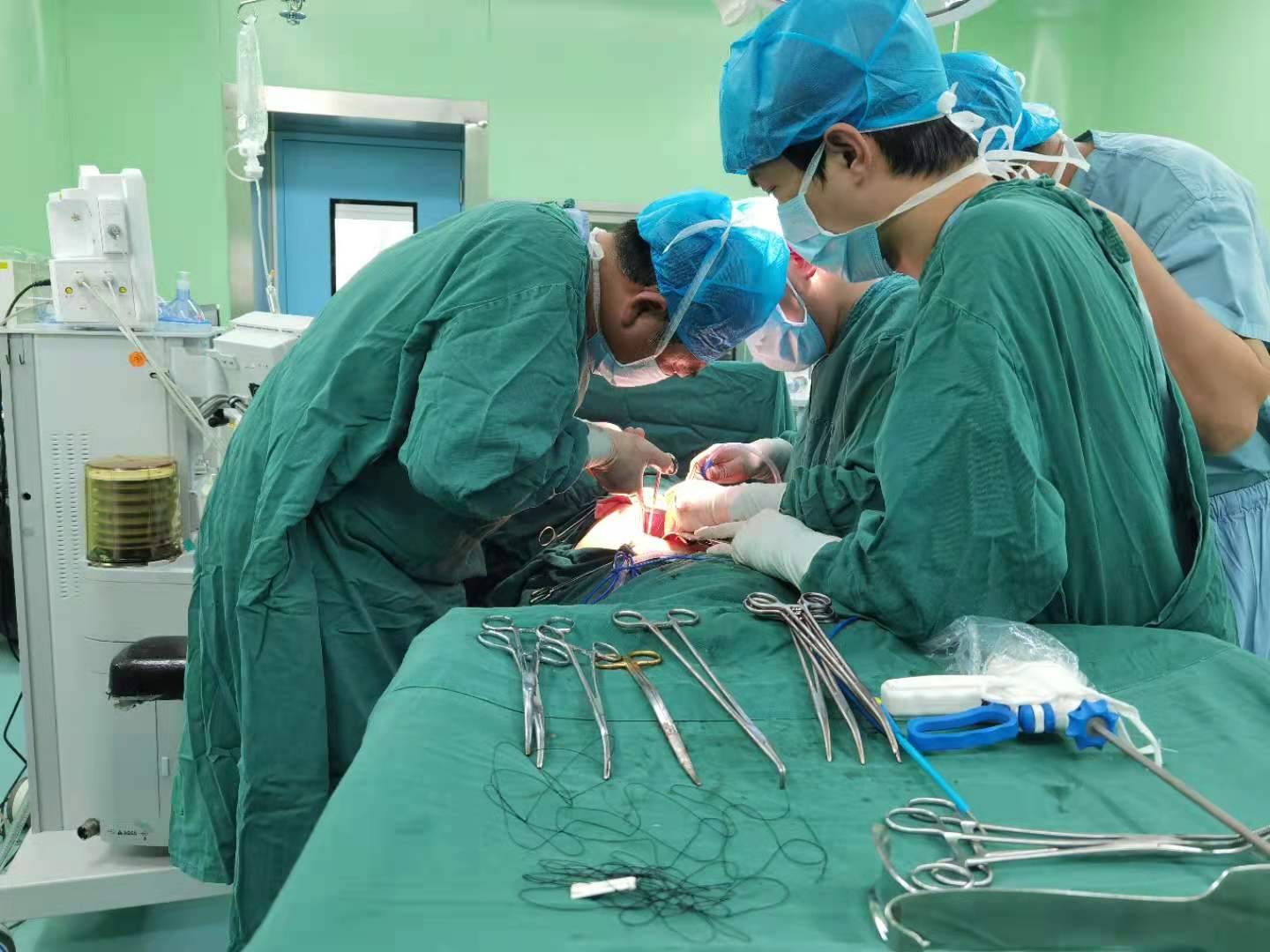 盘江总医院成功开展首例食管憩室切除+食管重建术