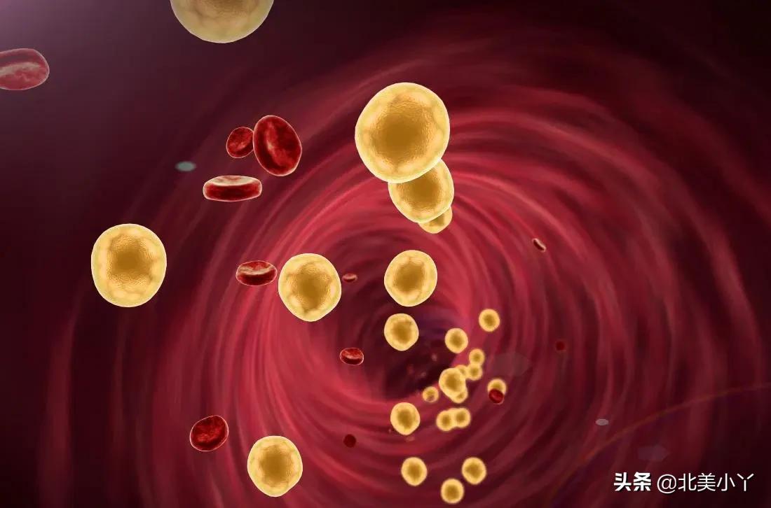 盐酸小檗碱能治疗三高吗,盐酸小檗碱降血脂主要作用