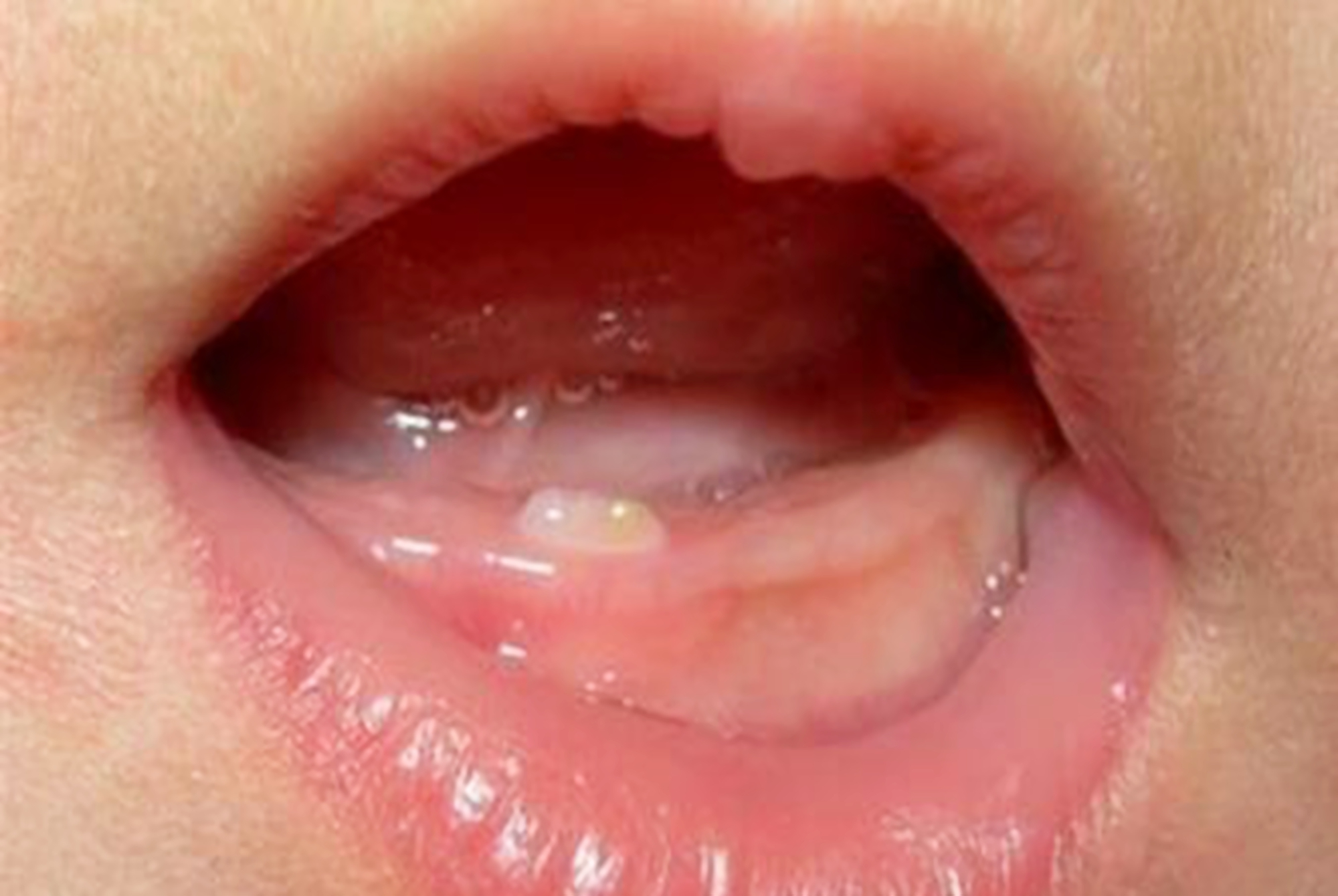 宝宝吃手很香还吧唧嘴,宝宝吃手和吃拳头